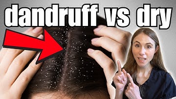 Distinguishing Dandruff From Dry Scalp: Expert Tips For Clearing Up Flakes
