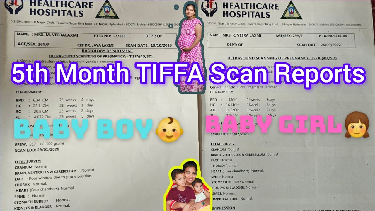 Baby boy&Girl 5th Month Tiffa Scan & నా first baby కి వచ్చిన metarnity ...