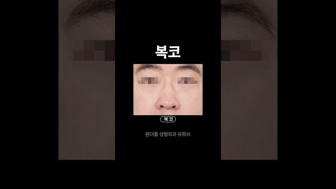 [Вандерфул Гоо сайхны мэс засал] Бүдүүн хамар