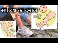 अब सांप काटने पर कोई भी नही मरेगा | Snake bite first aid and treatment full information