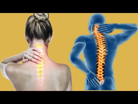 Video: Un nerv ciupit poate provoca dureri în piept?