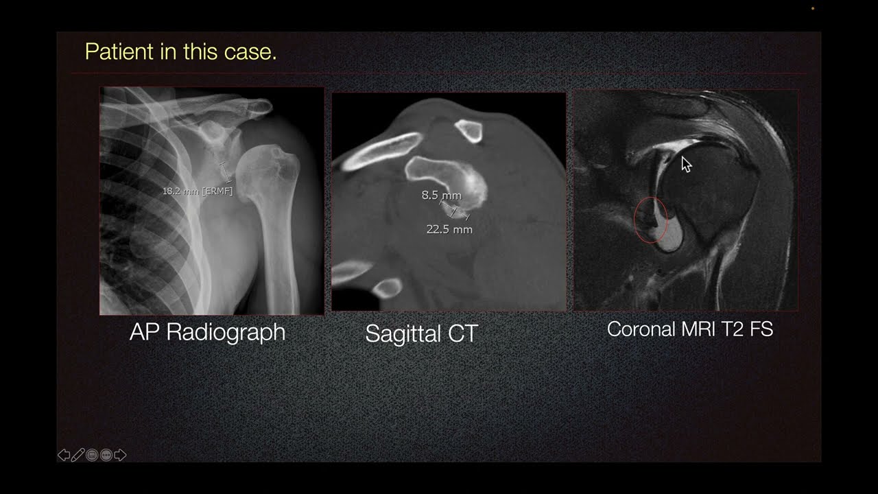 Sports Medicine Case 50 40yearold The Amateur Cliff Jumper YouTube