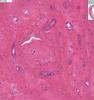 Shotgun Histology Dense Bone