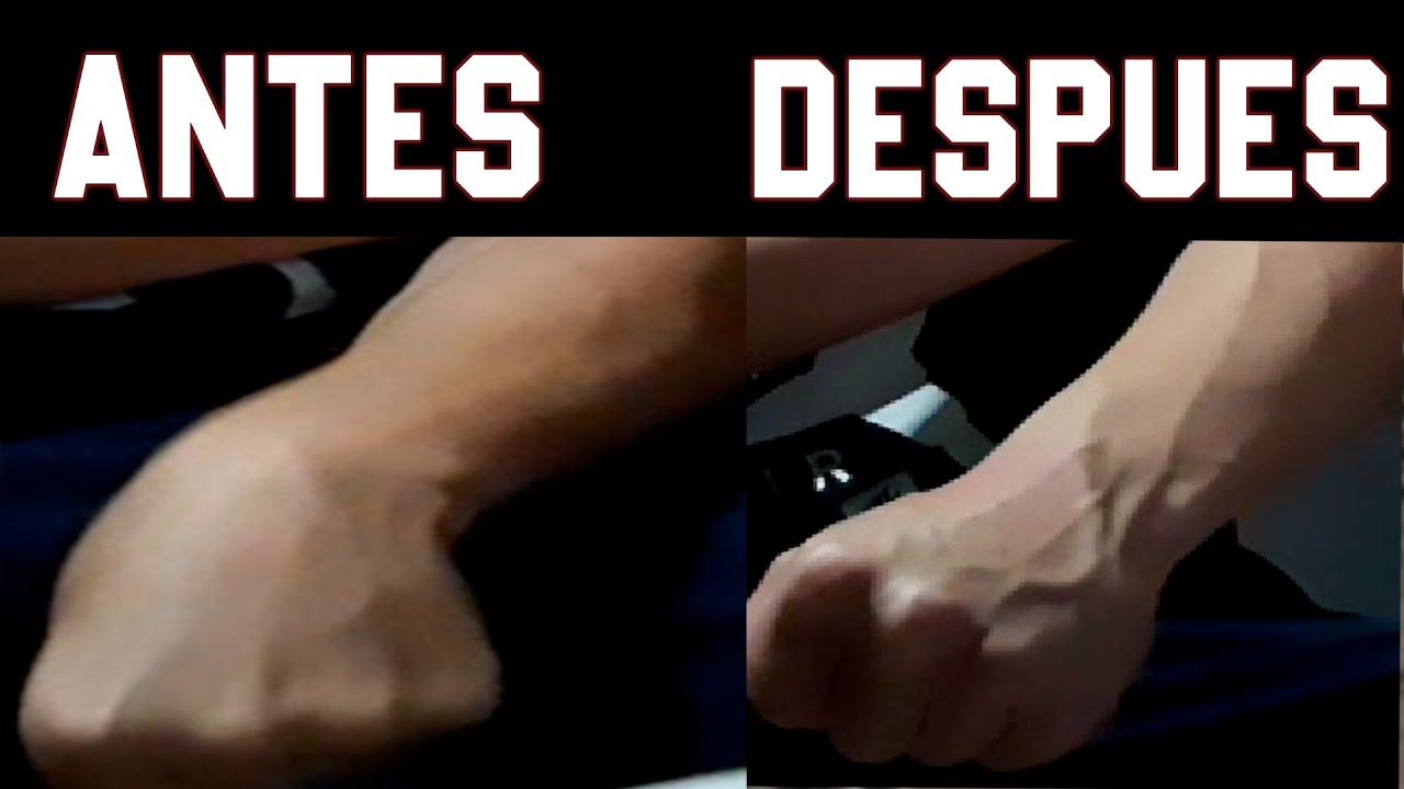 Como Cortarse Las Venas Correctamente NTQIR