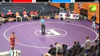 152 Vs. Bryan Burnett