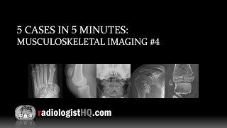 5 Cases in 5 Minutes: Musculoskeletal #4