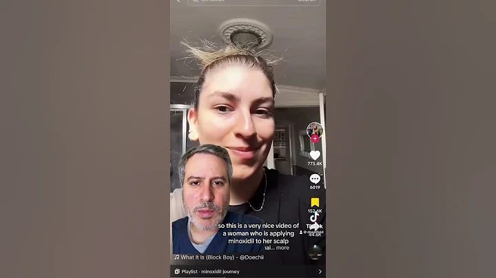 Minoxidil spray is most effective at helping to regrow your hair when applied correctly. ￼ #hair