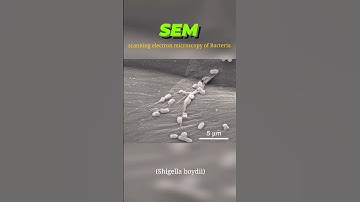 Electron Microscopy (SEM) | E.coli, S.aureus, Salmonella, Shigella, Gonorrhea, Clostridium #micro