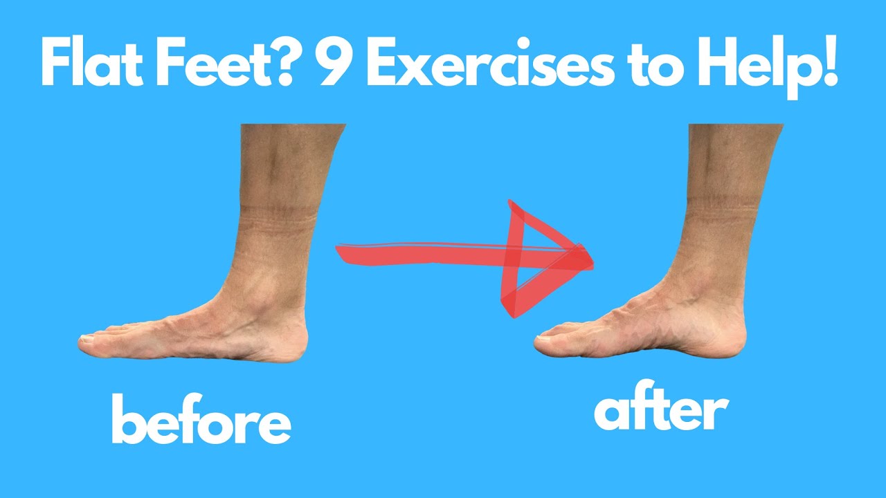 Flat Feet? 9 Exercises to Help! - YouTube