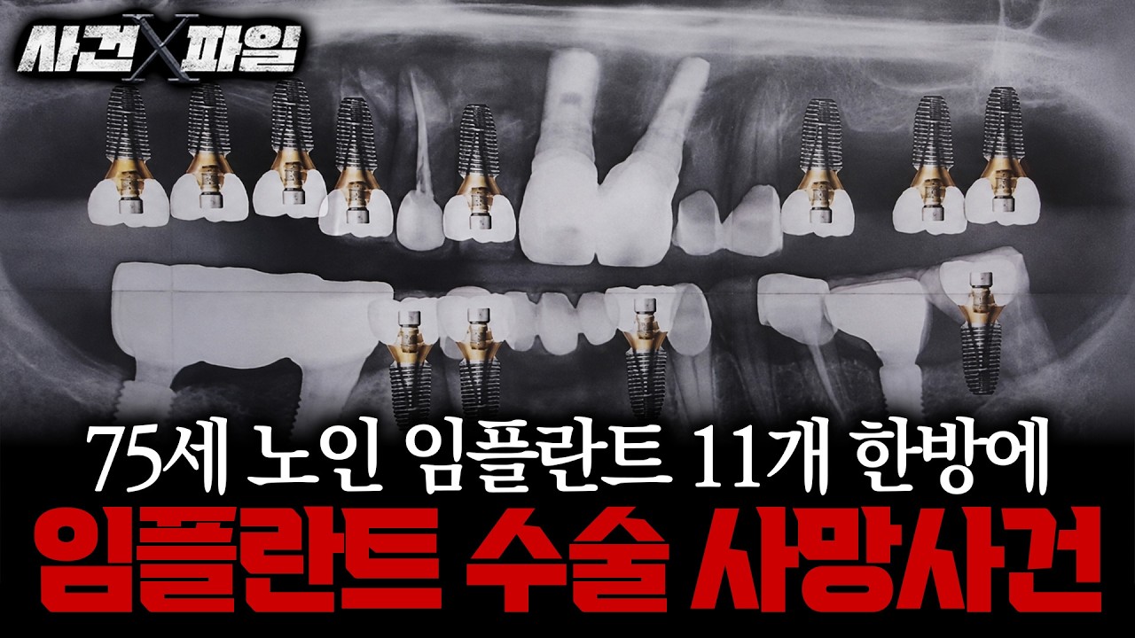 보이는 라디오 이미지