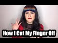 Storytime - How I Cut My Finger Off. Why They Couldn't Save It.