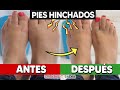 🦶🏻🔥 4 FORMAS de disminuir los PIES HINCHADOS durante el embarazo