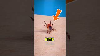 ⚠️ Never Remove a Tick Like This! The Dangerous Mistake Most People Make