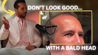 Hair Loss DESTROYED Tristan Tate's Life