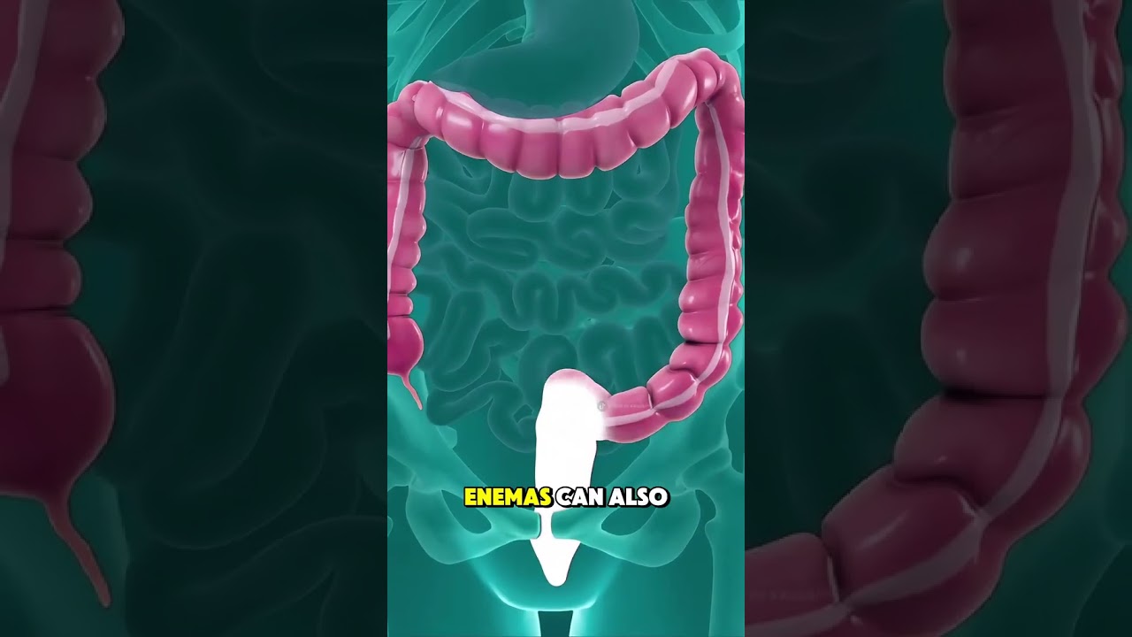 How Enema Therapy Works? (3D Animation) 