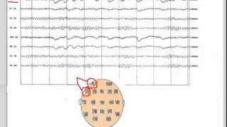 EEG  101