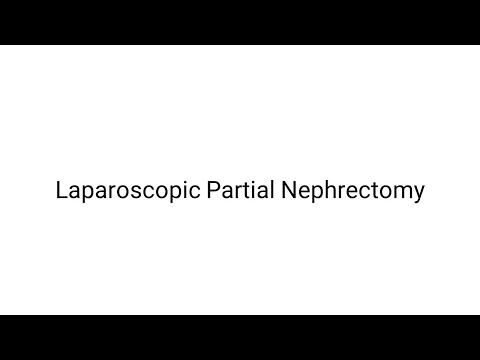 Laparoscopic Partial Nephrectomy | Kidney Cancer Removal Surgery | Laparoscopic Kidney Surgery