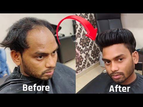 Best Hair Patch in india | Latest haircut | Hair Patch in Sambalpur/Bargad  | Hair wig/Patch for men - YouTube