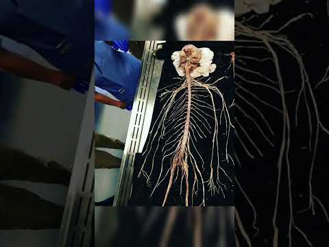 real nervous system #anatomy #human #body