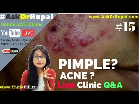 Pimple Acne kyun hote hai ? Causes & Treatment solution #AskDrRupal Live FREE Clinic  (Hindi/Eng)