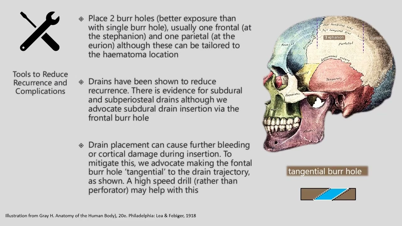 Video 47 1 Medical and Surgical Management of Chronic Subdural Hematoma