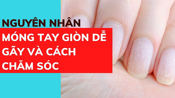 Móng tay giòn hay gãy là bị bệnh gì năm 2024