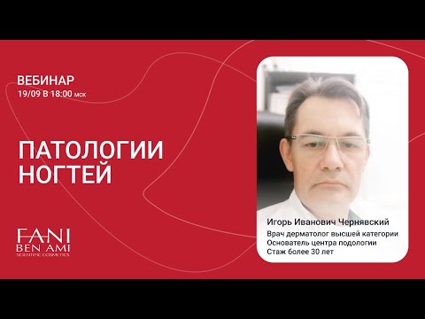 Video: Онихоптоз деген эмне?