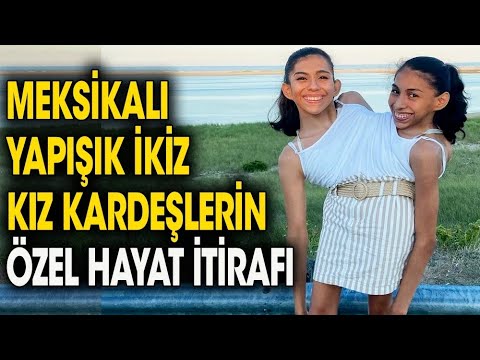 Yapışık Kız Kardeşler Özel Hayatlarını İtiraf Ettiler. Her Soruyu Açıkça Cevapladılar