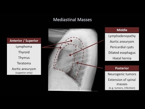 Video: Adakah rongga perikardial dalam mediastinum?