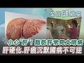 【全民健檢室】你有小心"肝"嗎? 脂肪肝成常見文明病之一 代謝出問題恐釀肝硬化.肝癌.胰臟癌 代謝症候群演化沉默國病 戒糖.多運動守護心肝｜TVBS新聞 @TVBSNEWS01
