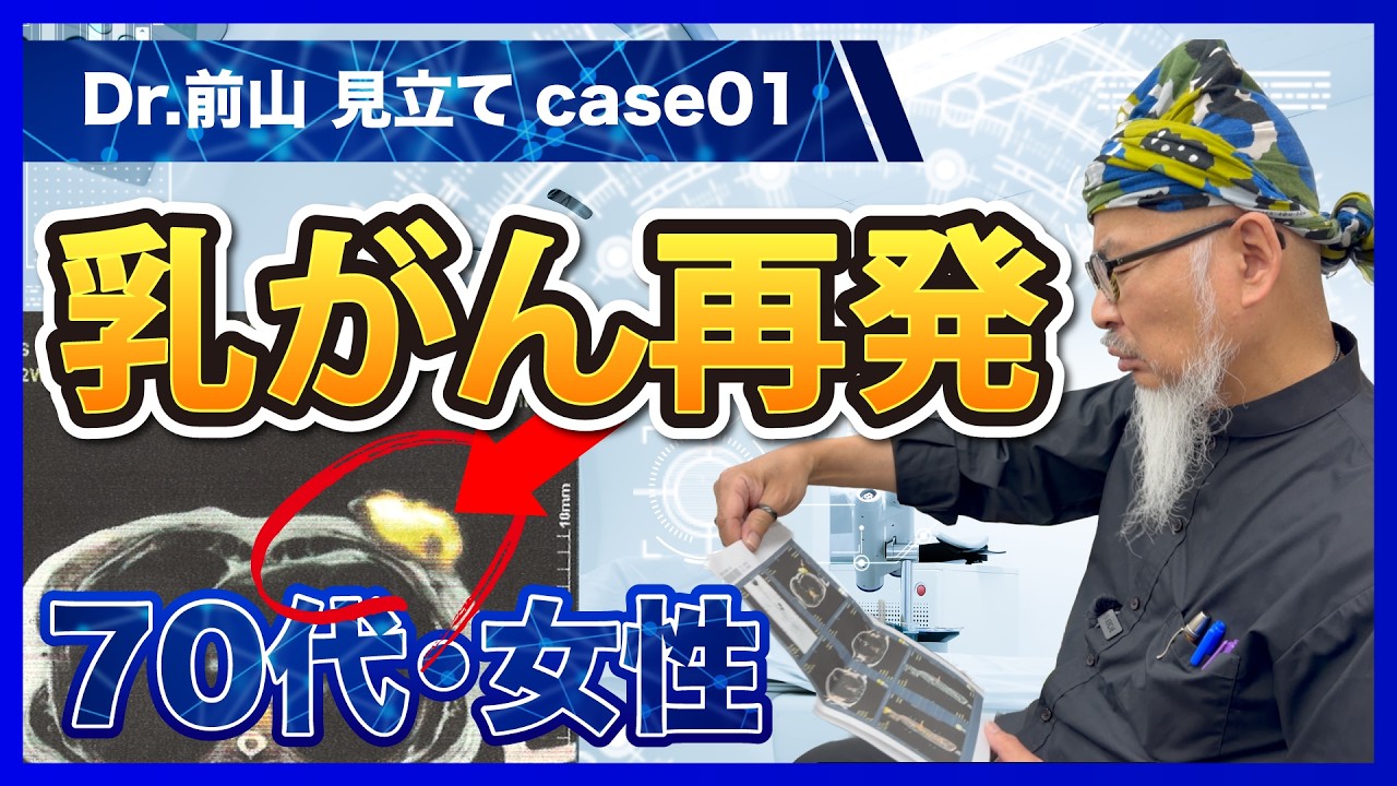 【Dr.前山見立て】70代女性・乳がん再発｜血液検査・CT所見を読む