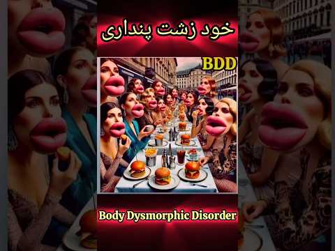 بدریخت انگاری بدن اختلالی است که باعث می شود نقص های خیالی در ظاهر واقعی به نظر برسند