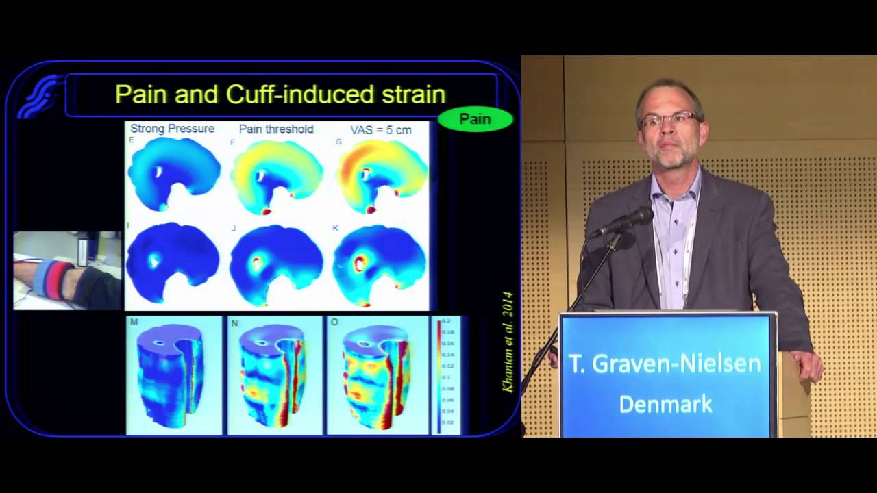 Assessment of musculoskeletal pain mechanisms and the importance for management