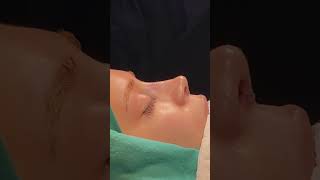 Qoruyucu Rinoplastika Əməliyyatı 055 218 76 66 Əlaqə