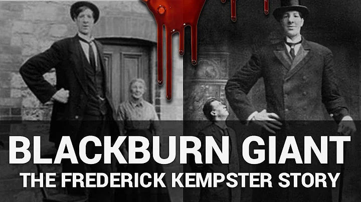 The Blackburn Giant - The Frederick Kempster Story | Real Story | True Documentary