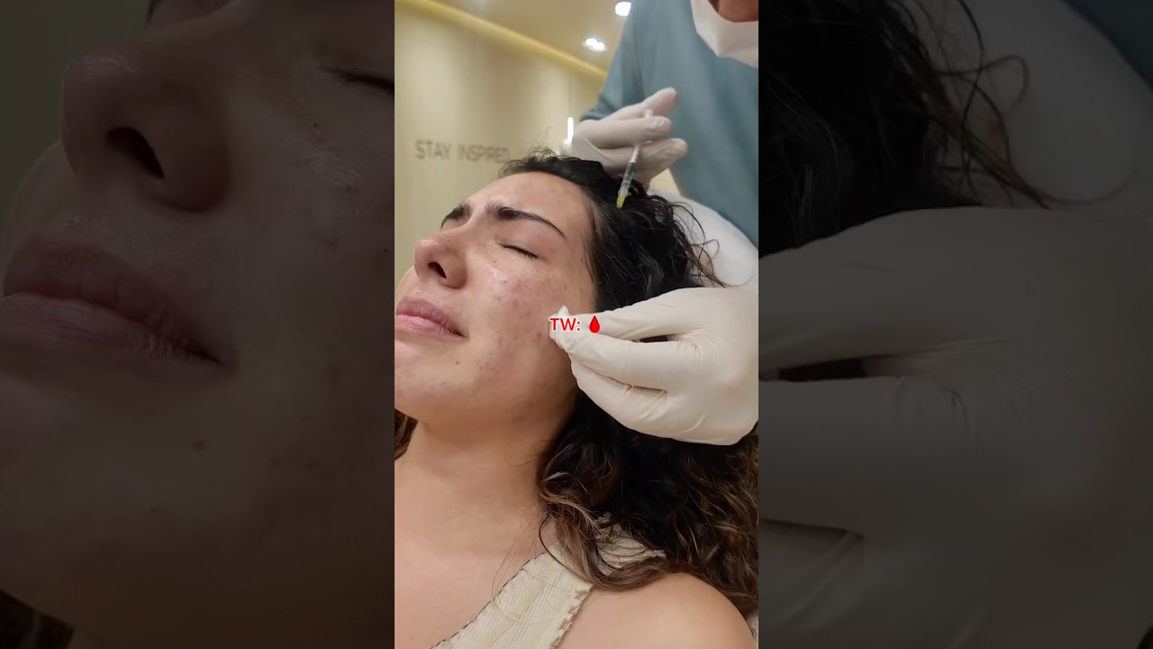 24 hours of beauty treatments in Turkey PART 1 