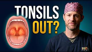 Adult Tonsillectomy Explained: Surgery, Recovery, Risks & What to Expect