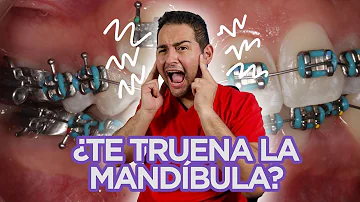 ¿Por qué se me mueve la mandíbula?