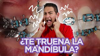 ”ME TRUENA LA MANDÍBULA”  ¡DEBERÍAS VER ESTE VIDEO! (CASO de CHASQUIDOS RESUELTO en 2021)