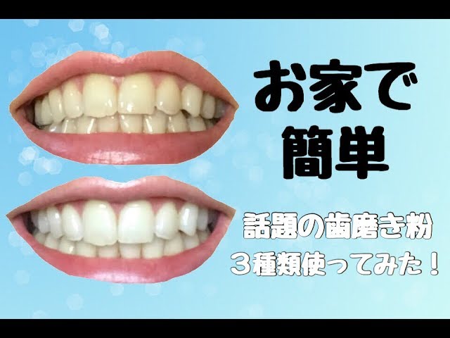 歯磨き粉でここまで歯が白くなった Youtube 歯磨き粉でここまで歯が白くなった Youtube