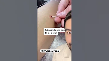 ¿Se pueden asfixiar las garrapatas?