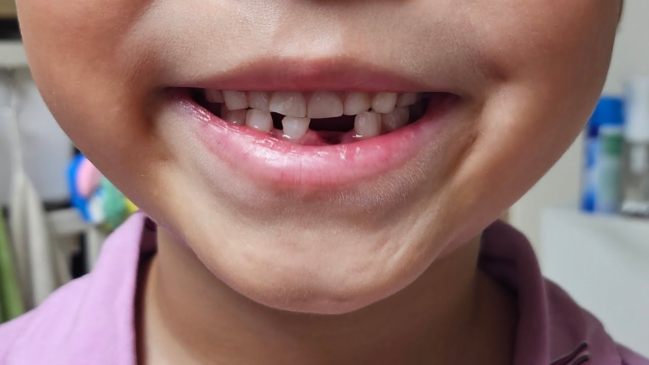 너의 첫 이빨은 엄마가 빼주고 싶어😌