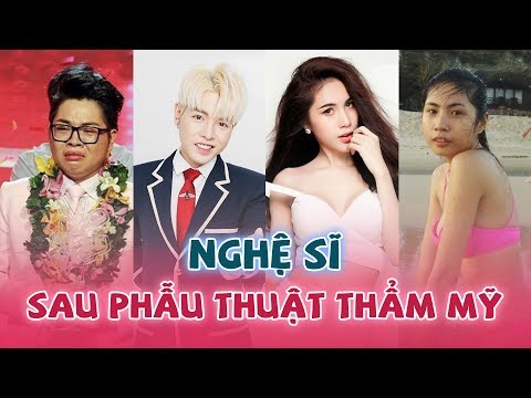 Video: Kỳ Tích Phẫu Thuật Thẩm Mỹ: Ảnh Của Các Nữ Diễn Viên Nổi Tiếng Trước Và Sau Khi Phẫu Thuật Thẩm Mỹ