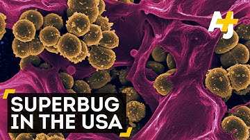 Antibiotic-Resistant Superbug Found In The U.S.