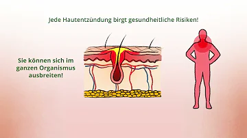 Wie lange dauert es bis ILON Salbe wirkt?