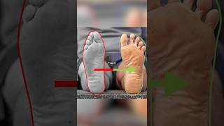 What Happens To Your Feet When You Wear Crocs For 7 Years Straight?