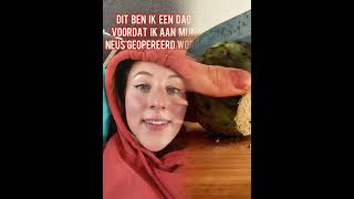 Pov Een Uur Voor Mijn Neusoperatie