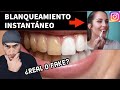 Blanqueamiento dental instantáneo de Instagram. ¿Realmente Funciona?