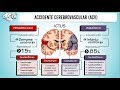 ACCIDENTE CEREBROVASCULAR