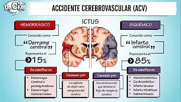 ¿Los accidentes cerebrovasculares provocan daños cerebrales permanentes?